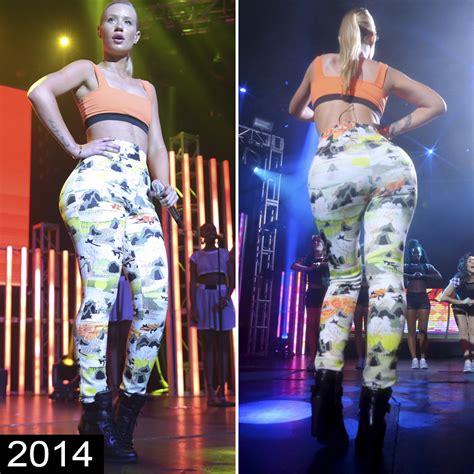 iggy azalea fake butt|The evolution of Iggy Azalea’s bum